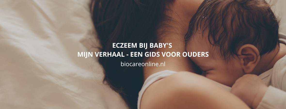 Eczeem bij baby’s. Mijn verhaal - een gids voor ouders