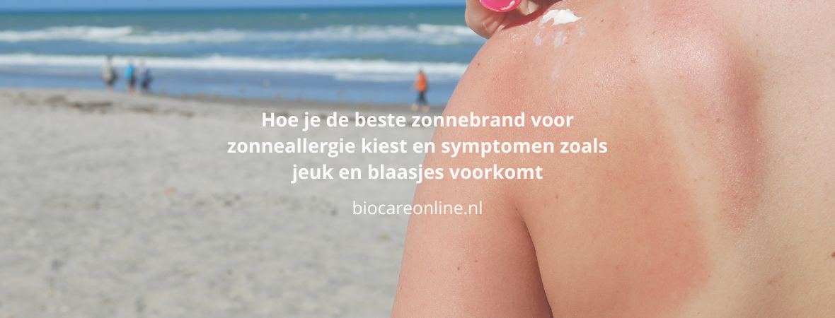 Hoe je de beste zonnebrand voor zonneallergie kiest en symptomen zoals jeuk en blaasjes voorkomt